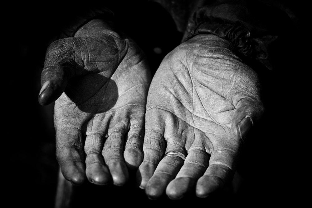 Mani di un anziano lavoratore agricolo (foto ©  Di Mark Strozier/Shutterstock)