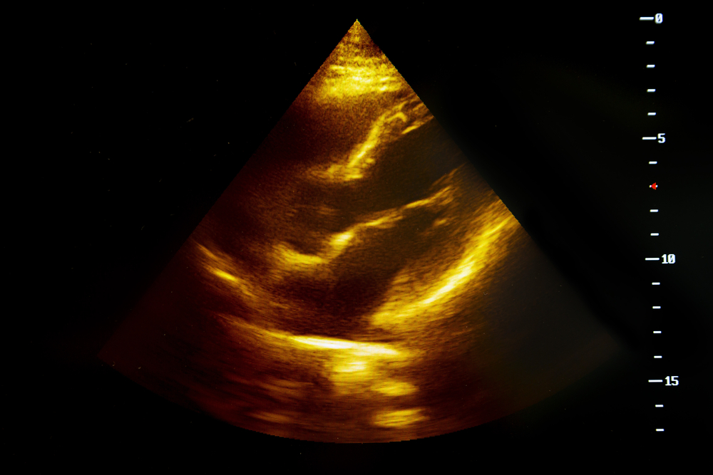 Aborto-selettivo-in-Montenegro-si-pratica-ancora