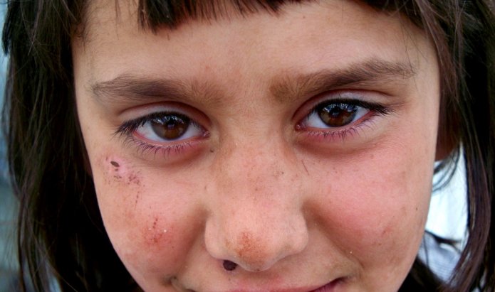 Dopo-il-Kosovo-in-Italia