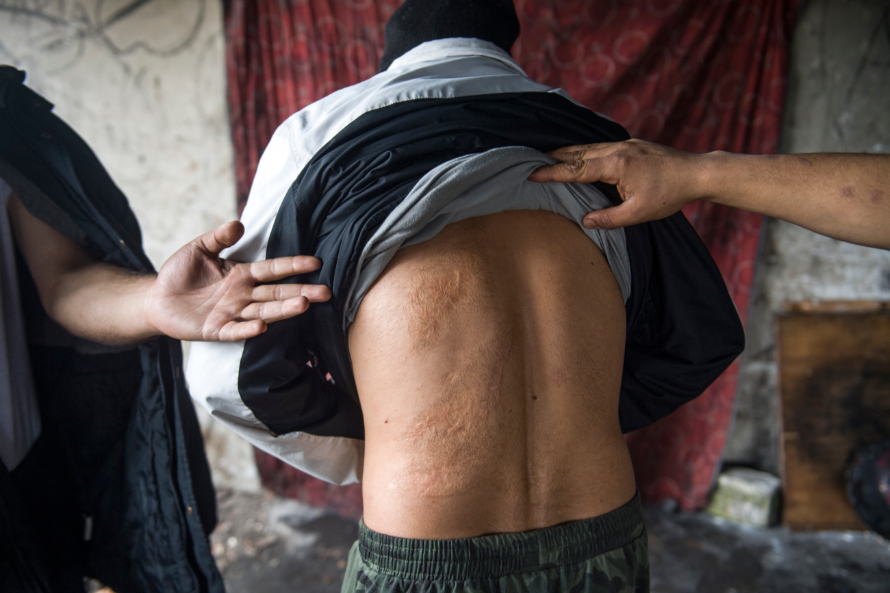 Respinto-e-picchiato